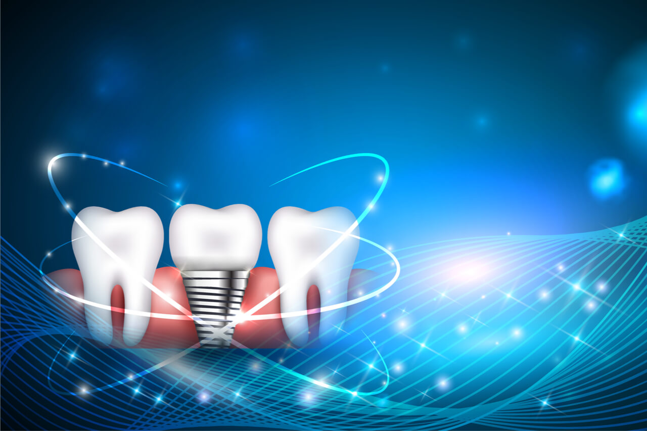 modernized dental implants