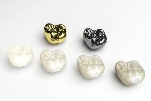 gold dental crowns